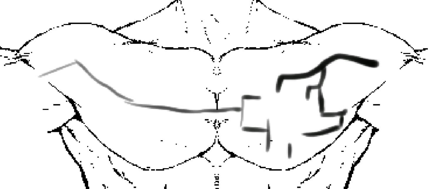 Chest Image